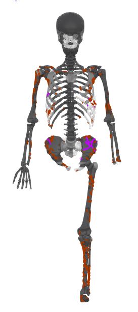 Schematic of the skeleton with cuts highlighted