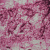 Laserablation
