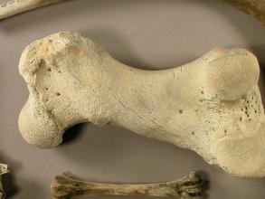 Bones